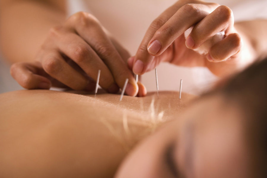 Applied Kinesiology and Acupuncture To Restore Balance In Your Body